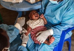 美国猴痘爆料新闻视频,最新爆料视频揭示惊人真相