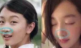 台湾综艺爆料谁整容新闻,明星整容真相大曝光！