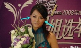 台湾综艺爆料谁整容新闻,明星整容真相大曝光！